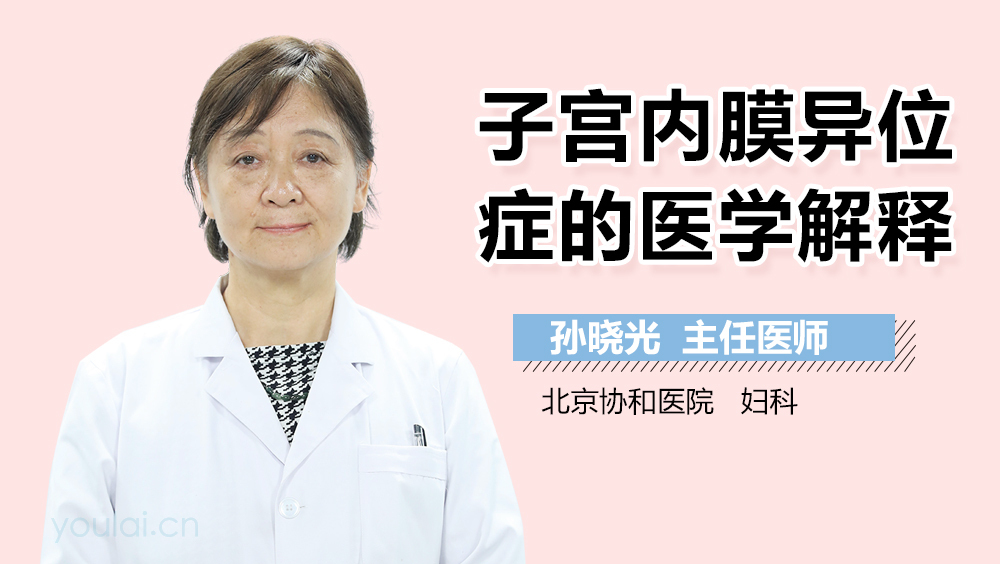 子宫内膜异位症的医学解释