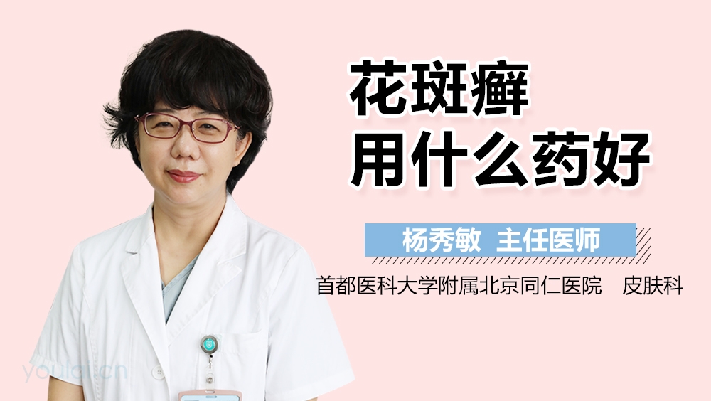 花斑癣用什么药好