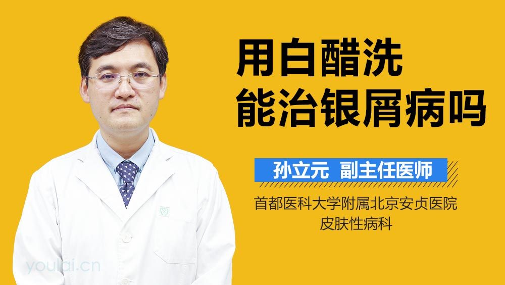 用白醋洗能治银屑病吗