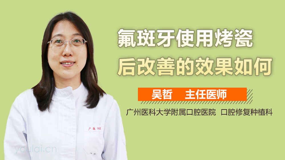氟斑牙使用烤瓷后改善的效果如何