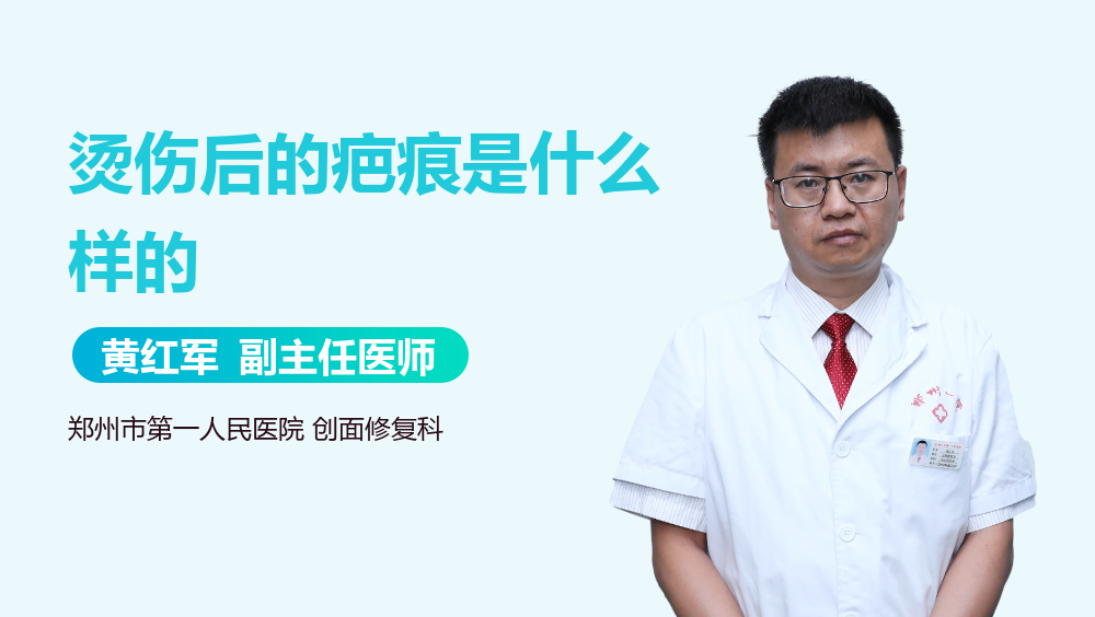 烫伤后的疤痕是什么样的