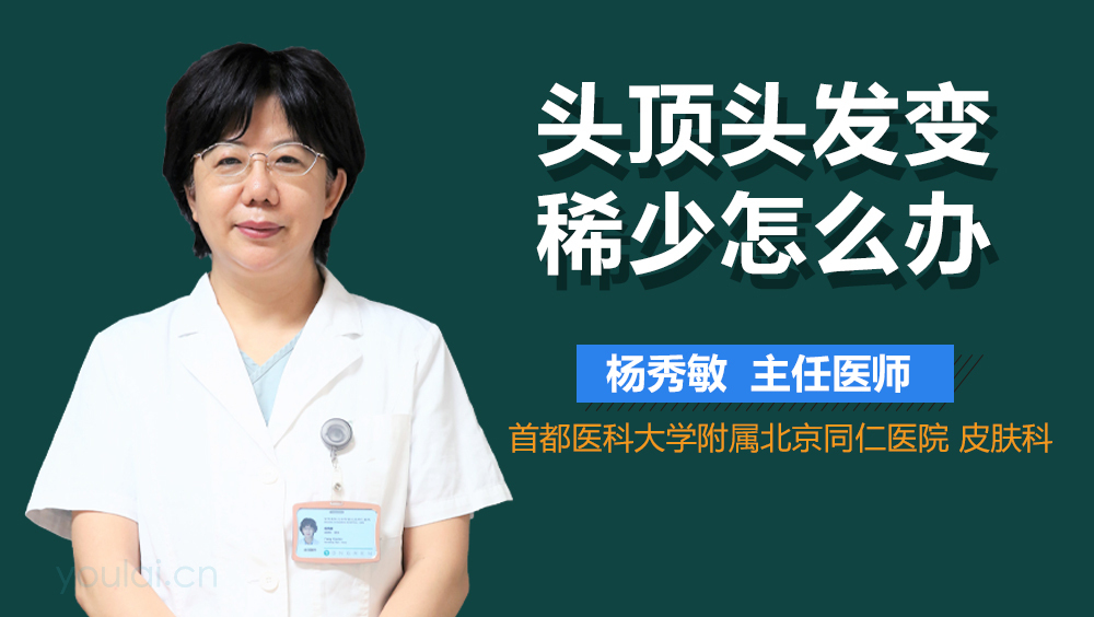 头顶头发变稀少怎么办
