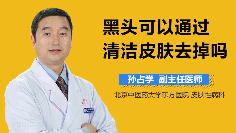 黑头可以通过清洁皮肤去掉吗