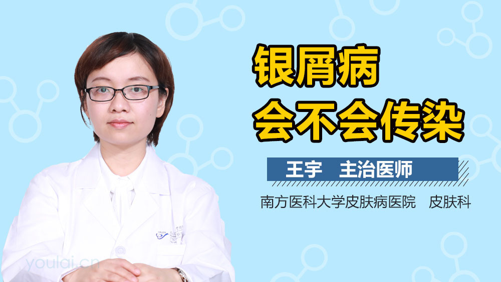 银屑病会不会传染