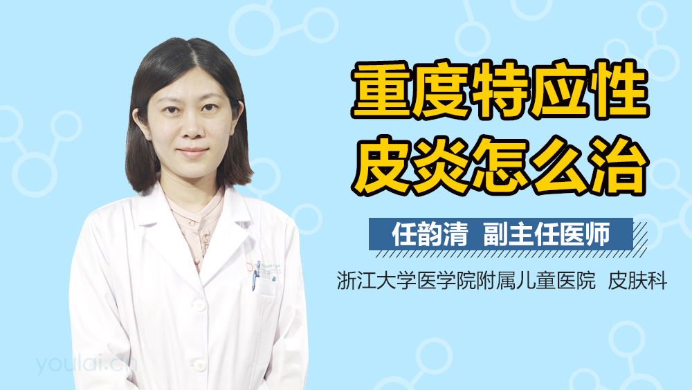 重度特应性皮炎怎么治