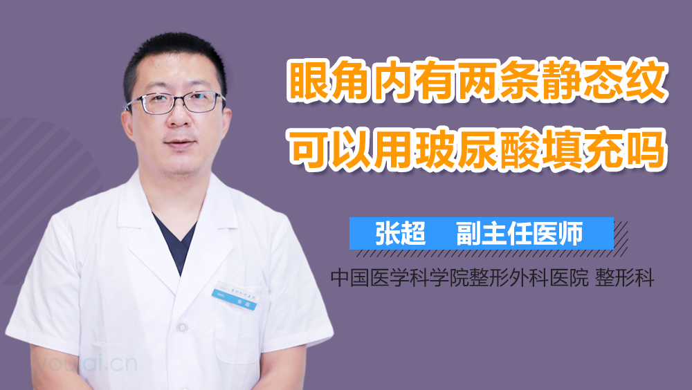眼角内有两条静态纹可以用玻尿酸填充吗
