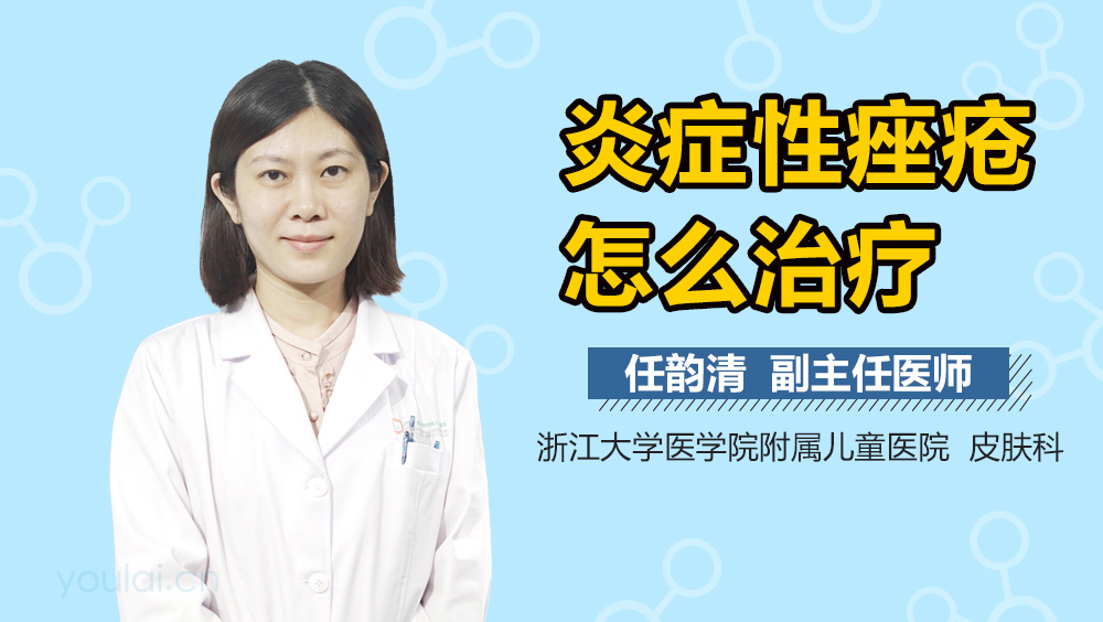 炎症性痤疮怎么治疗