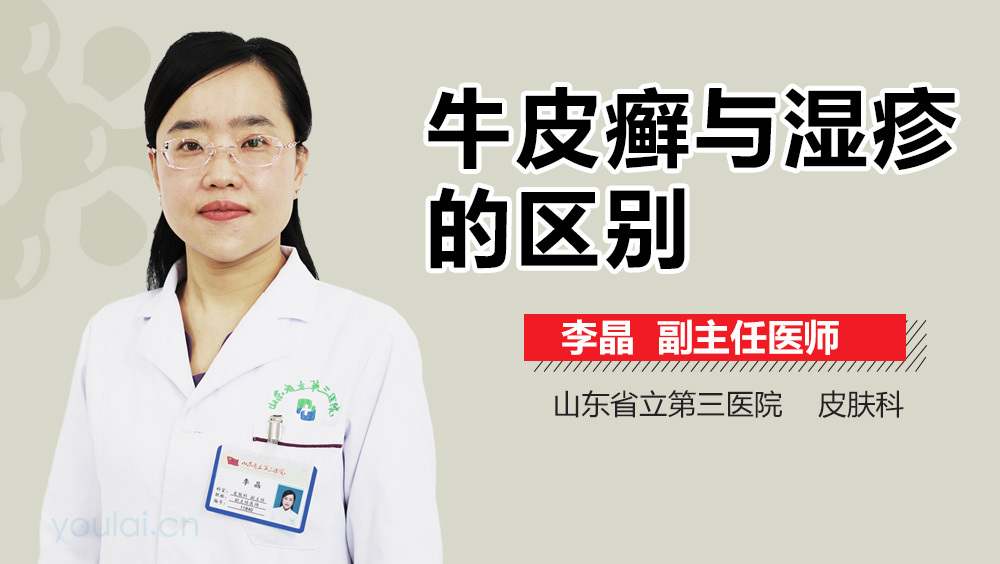 牛皮癣与湿疹的区别