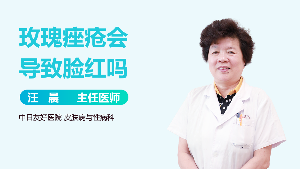 玫瑰痤疮会导致脸红吗