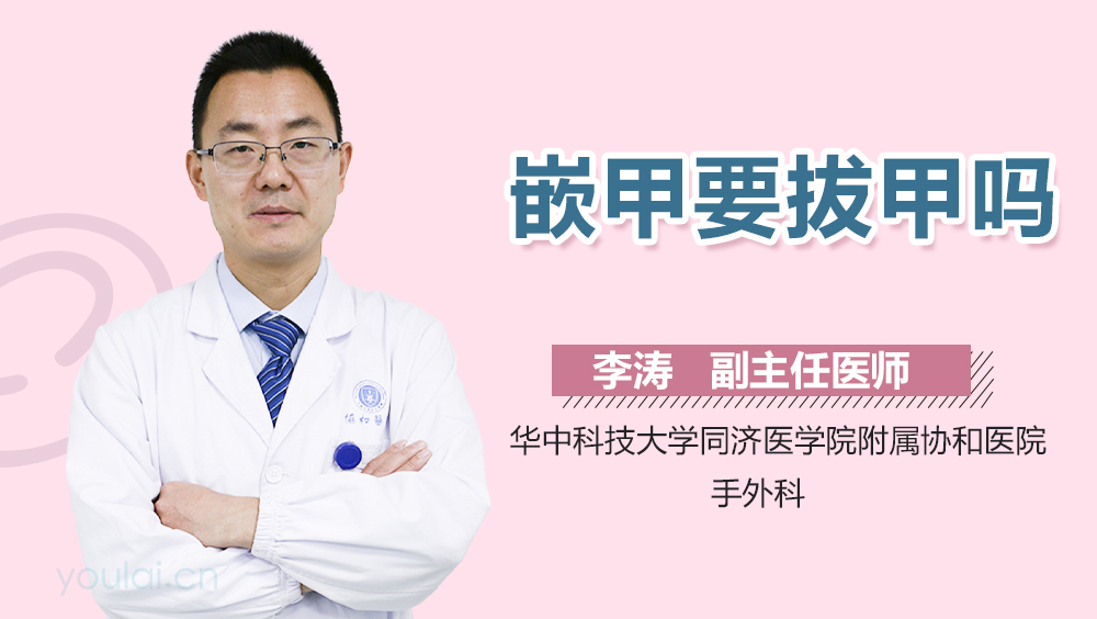 嵌甲要拔甲吗