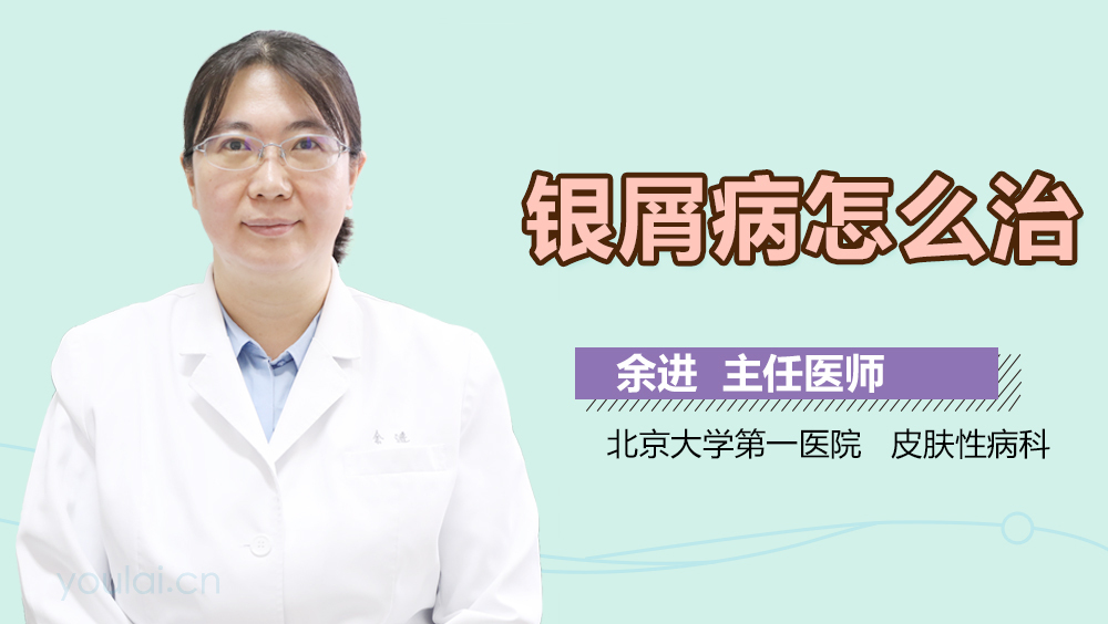银屑病怎么治