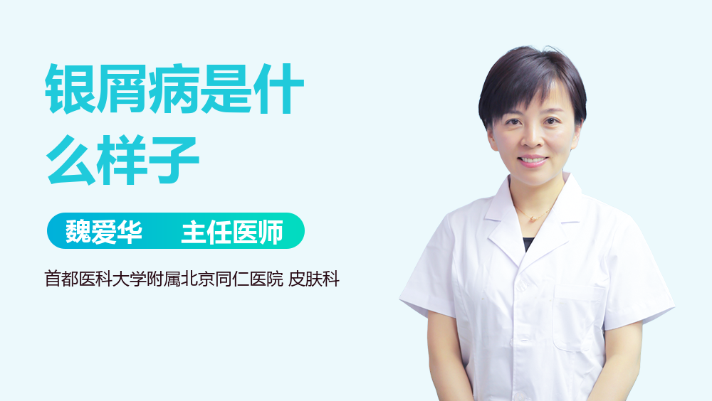 银屑病是什么样子