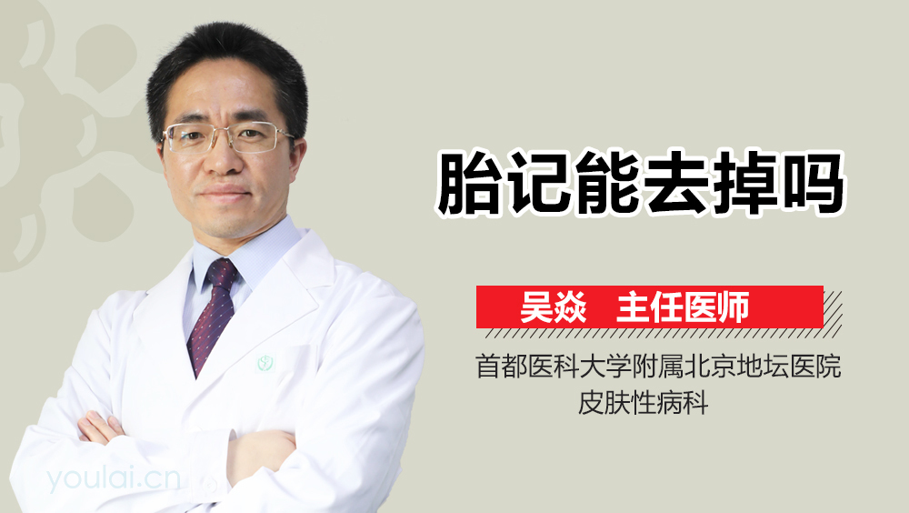 胎记能去掉吗