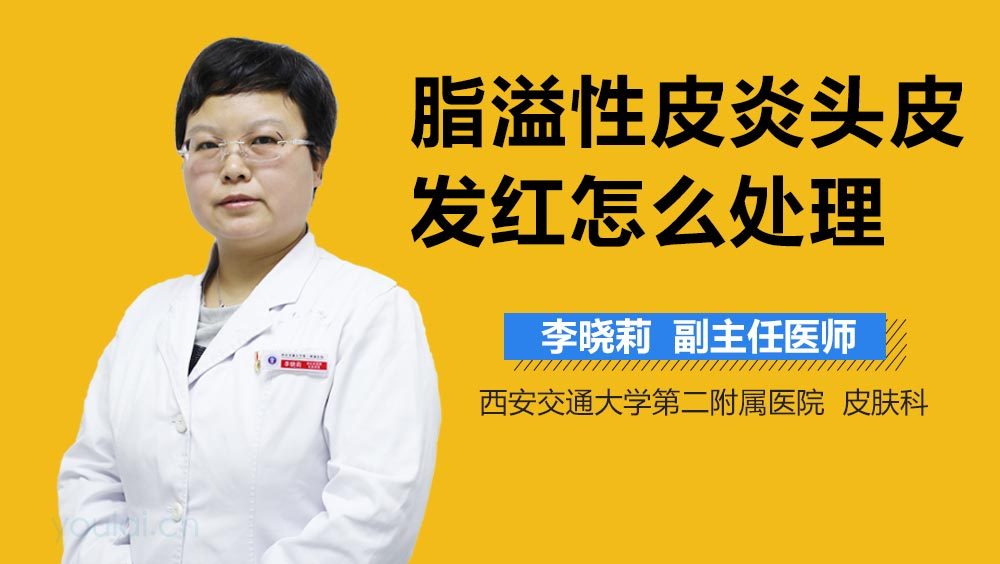 脂溢性皮炎头皮发红怎么处理