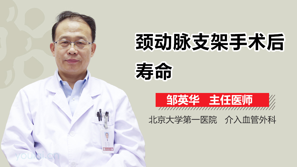 颈动脉支架手术后寿命