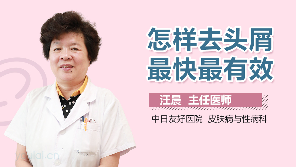 怎样去头屑最快最有效