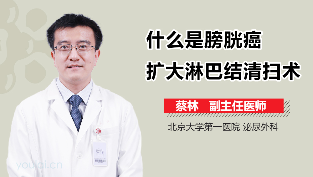 什么是膀胱癌扩大淋巴结清扫术