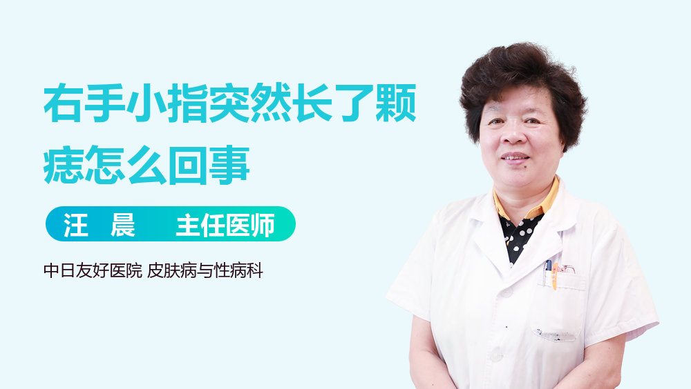 右手小指突然长了颗痣怎么回事