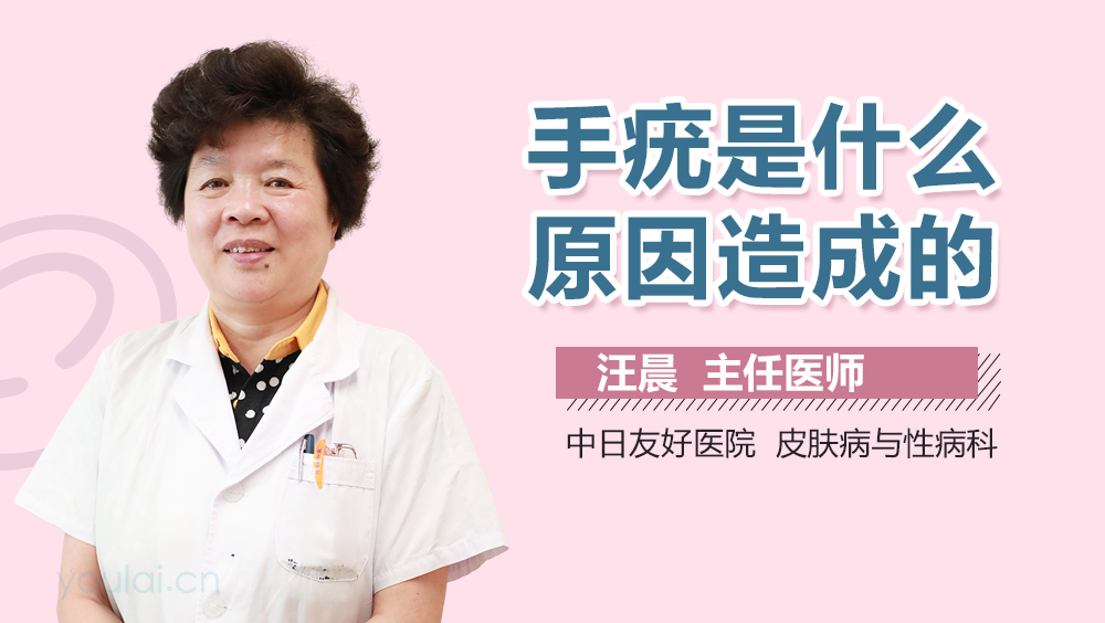 手疣是什么原因造成的