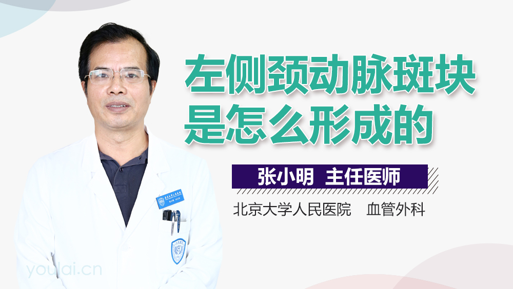 左侧颈动脉斑块是怎么形成的