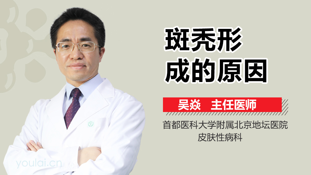 斑秃形成的原因