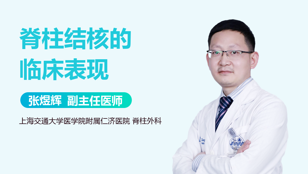 脊柱结核的临床表现