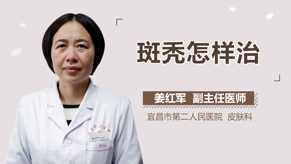 斑秃怎样治