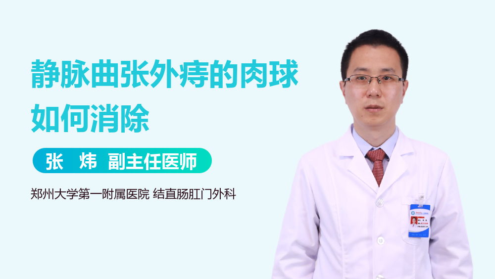 静脉曲张外痔的肉球如何消除