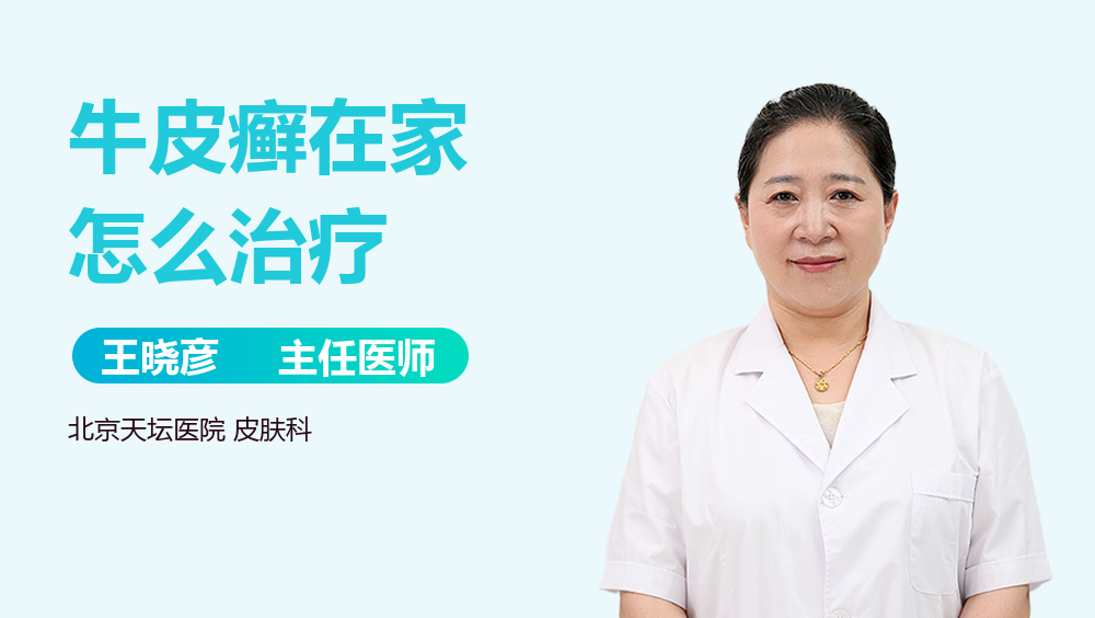 牛皮癣在家怎么治疗