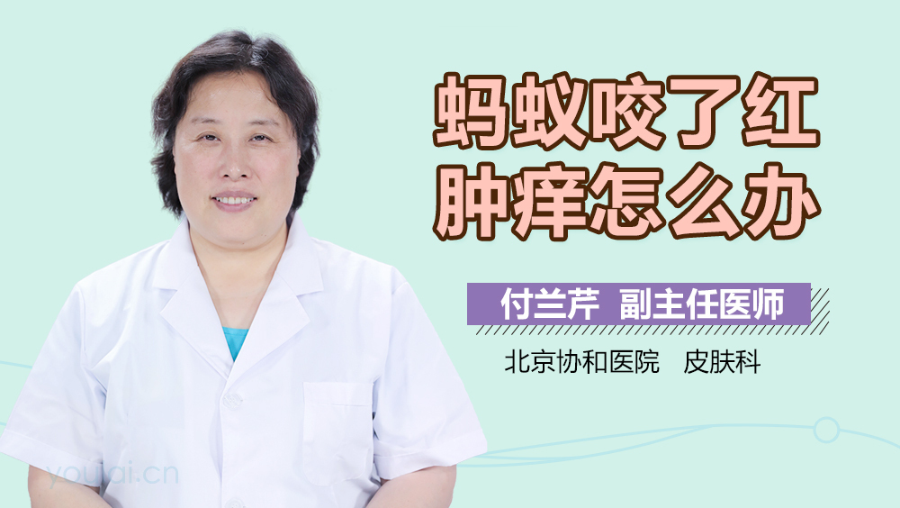 蚂蚁咬了红肿痒怎么办