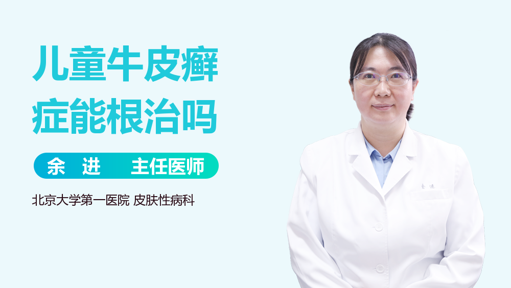 儿童牛皮癣症能根治吗
