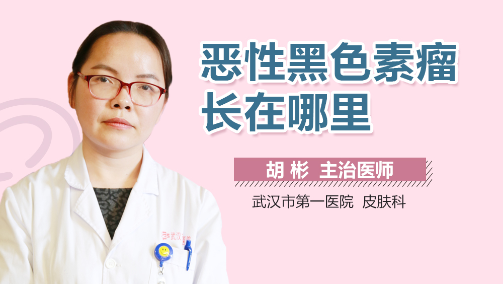 恶性黑色素瘤长在哪里