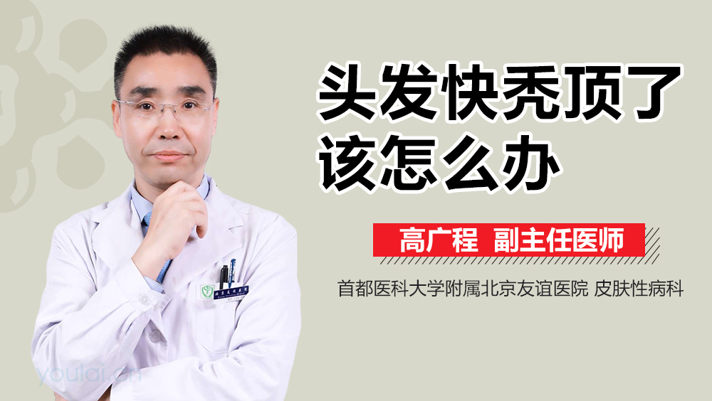 头发快秃顶了该怎么办