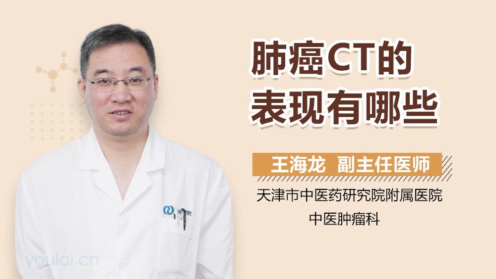 肺癌CT的表现有哪些