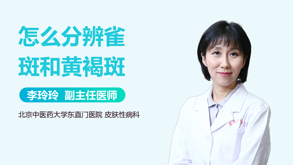 怎么分辨雀斑和黄褐斑
