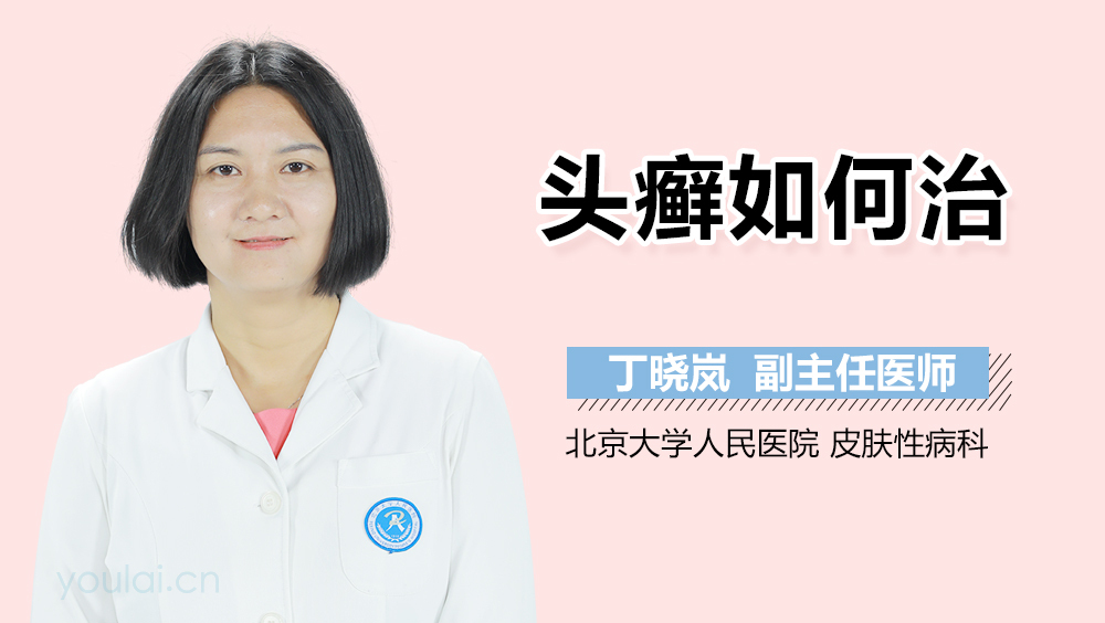 头癣如何治