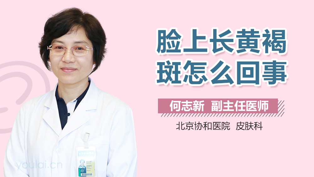 脸上长黄褐斑怎么回事