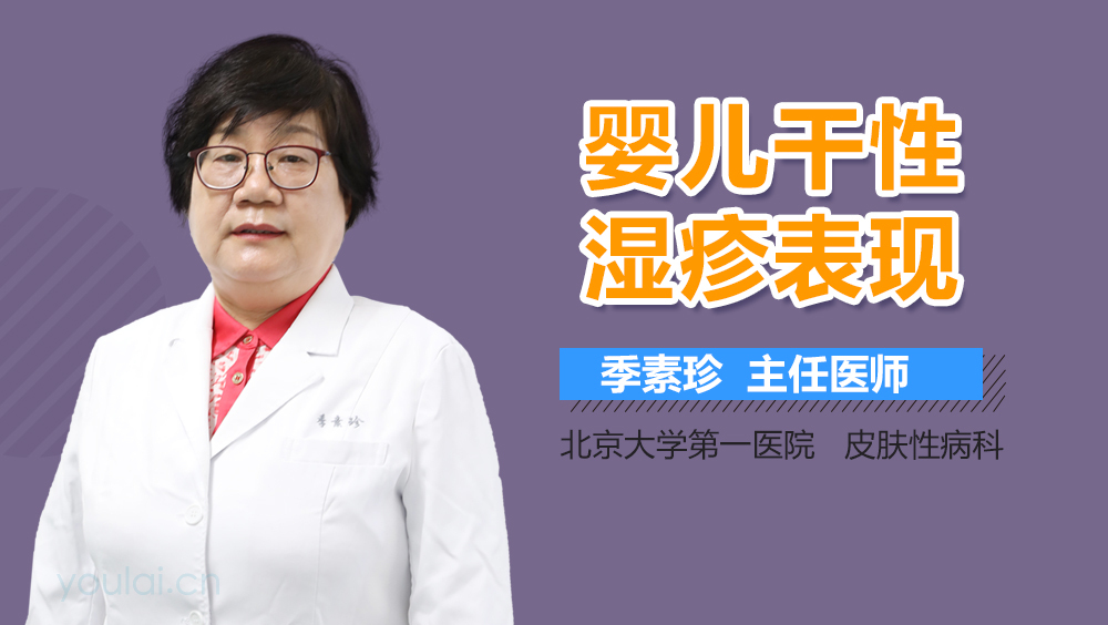 婴儿干性湿疹表现