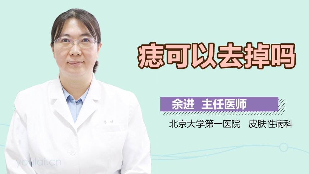 痣可以去掉吗