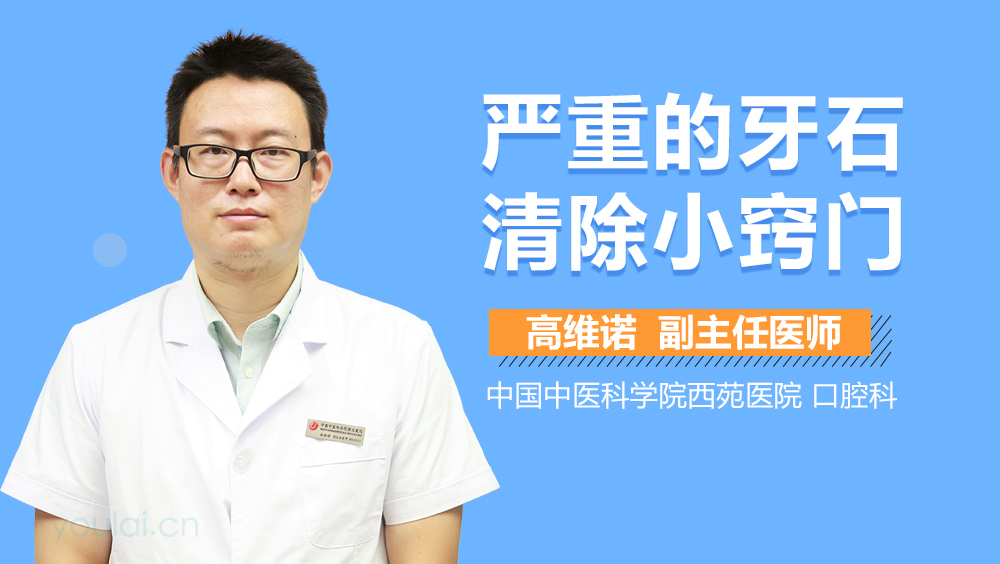 严重的牙石清除小窍门