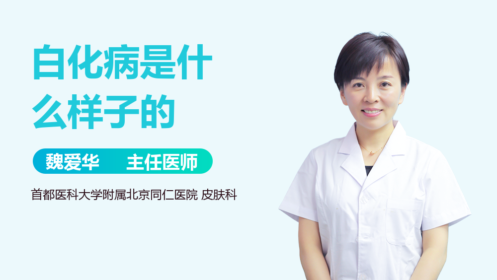 白化病是什么样子的