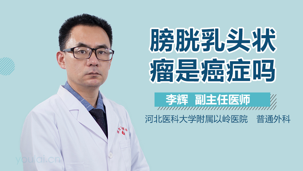 膀胱乳头状瘤是癌症吗