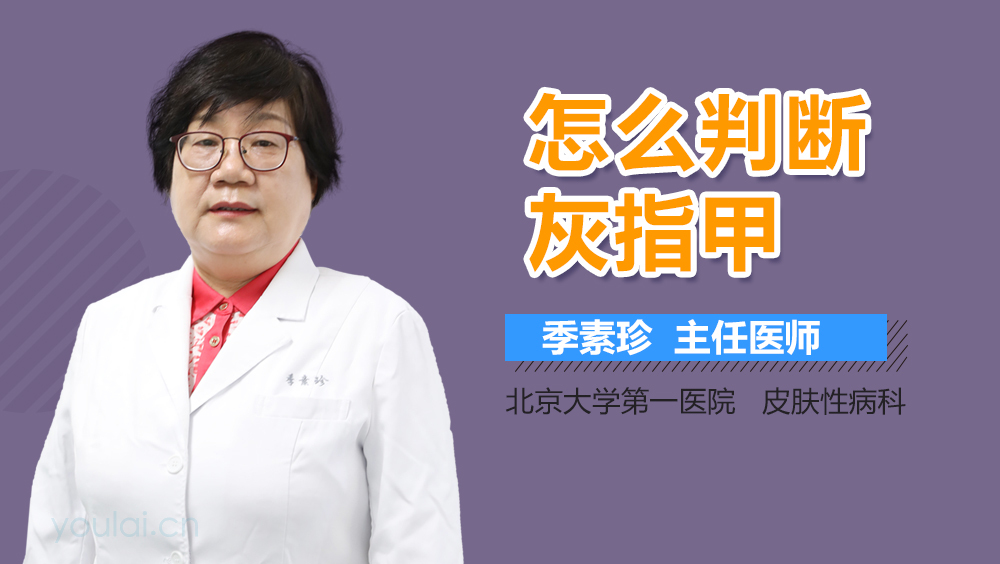 怎么判断灰指甲