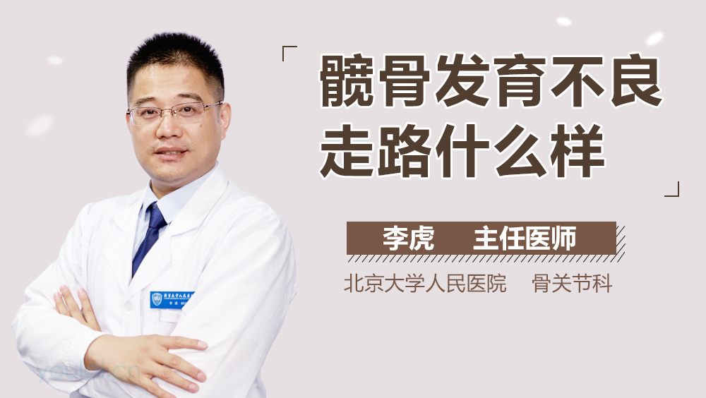 髋骨发育不良走路什么样