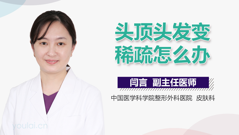 头顶头发变稀疏怎么办
