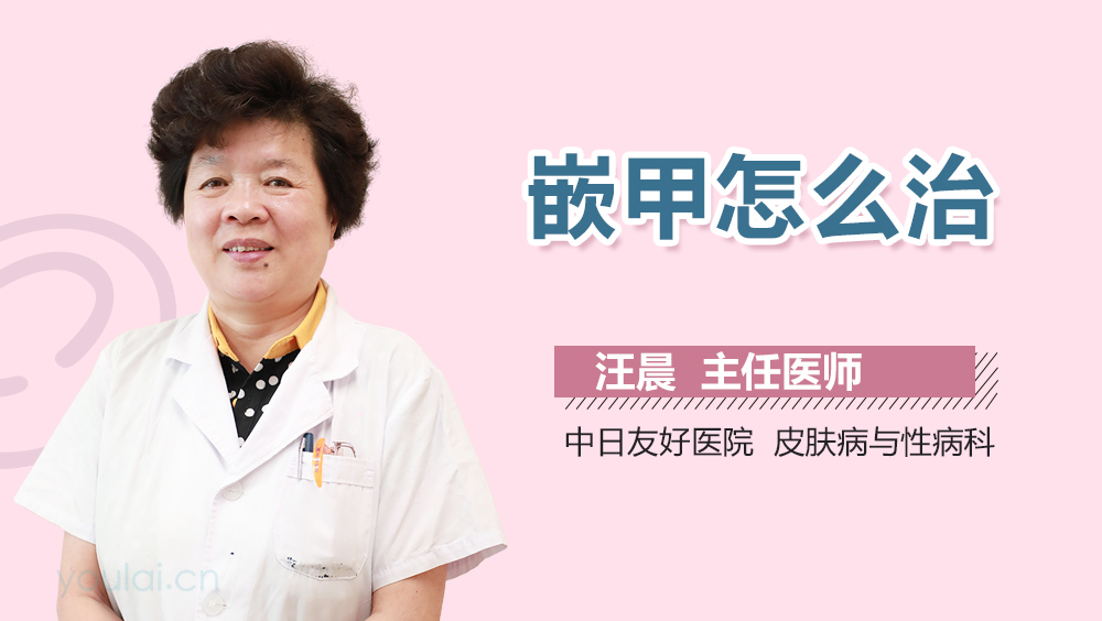 嵌甲怎么治