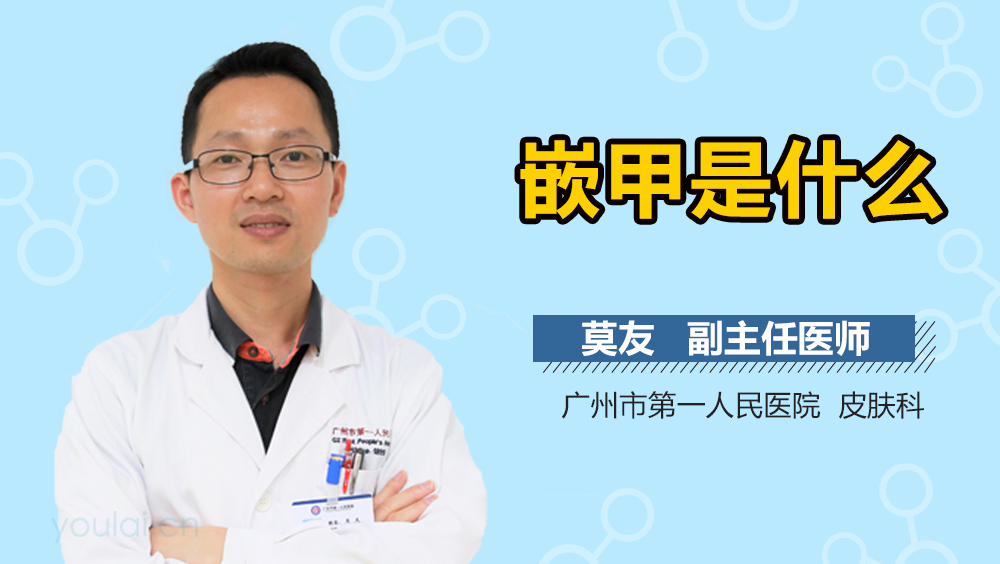 嵌甲是什么