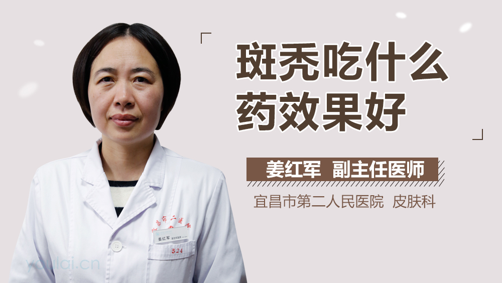 斑秃吃什么药效果好