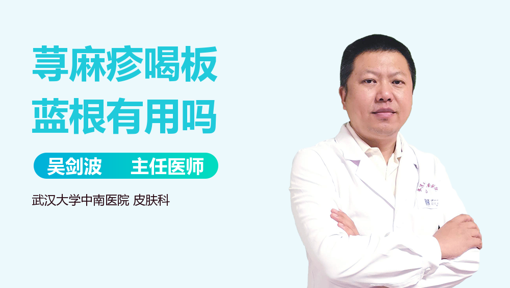 荨麻疹喝板蓝根有用吗