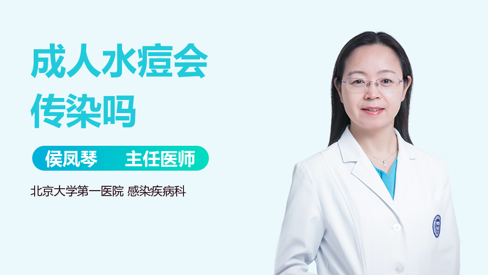 成人水痘会传染吗
